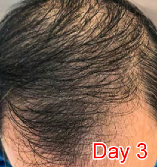 Day 3