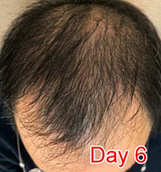 Day 6