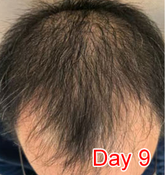 Day 9