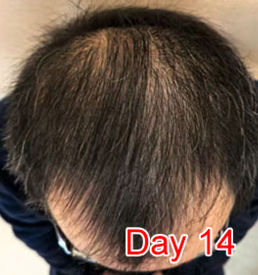 Day 14
