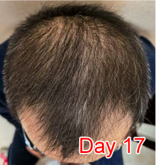Day 17