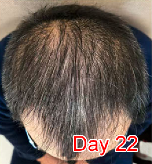 Day 22