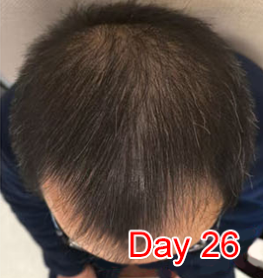 Day 28